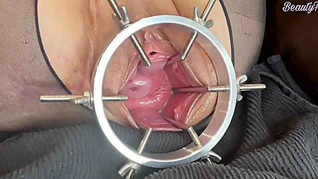 Phat Views Of My Wide Open Cunt And Cervix