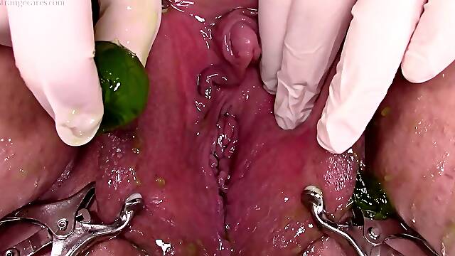 Bladder eggs and ruined orgasms